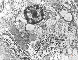 normal seromucinous salivary gland normal seromucinous salivary gland